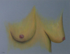 Breasts